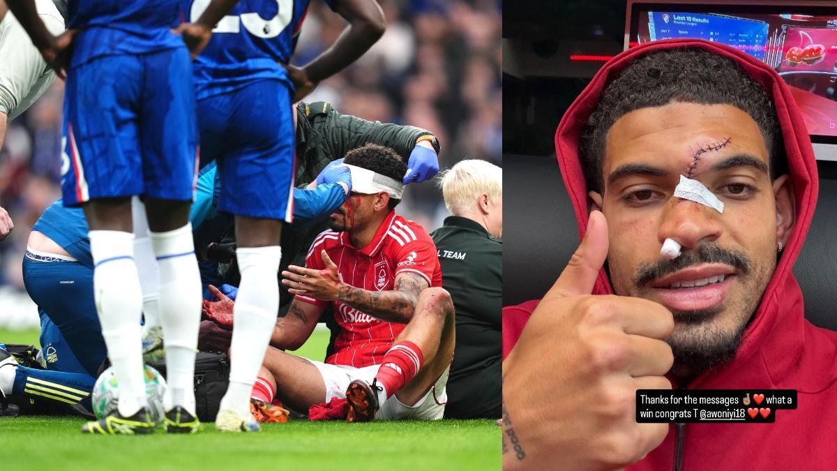 Gibbs-White y Robert Sánchez acaban con la cara ‘partida’